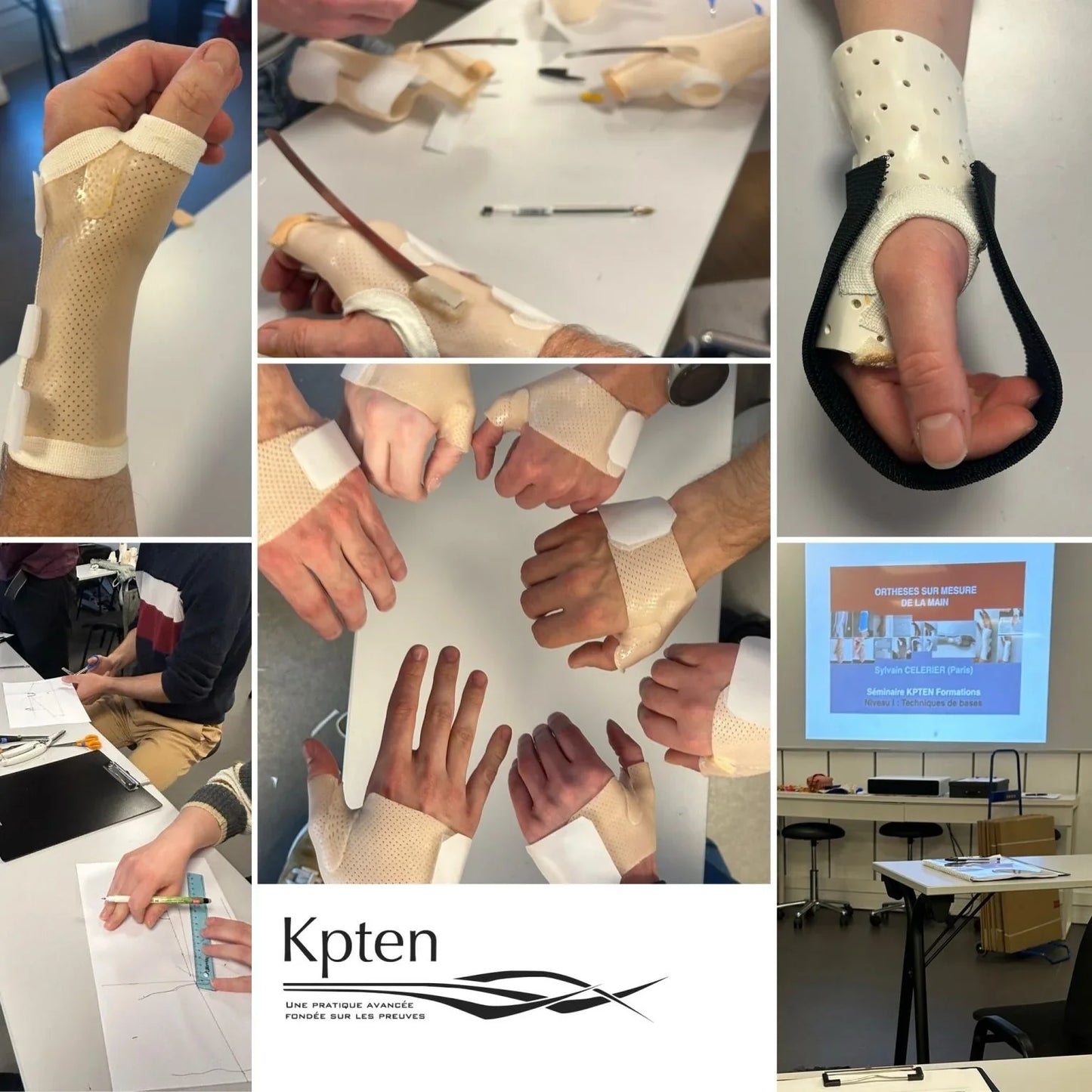 Atelier de formation Kpten sur orthèses de la main en kinésithérapie, fabrication et pose.