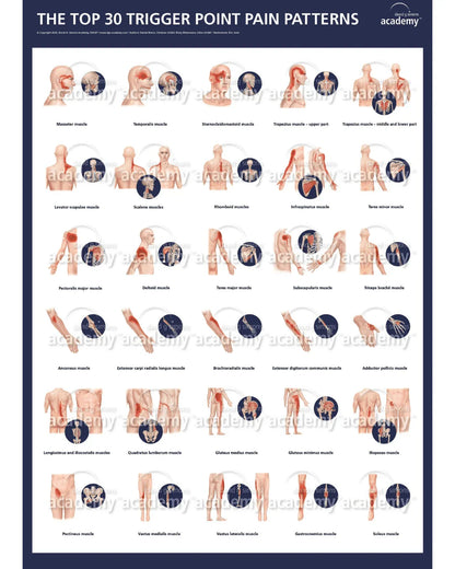 Schéma des 30 principaux points trigger douloureux, muscles illustrés pour formation kinésithérapie dry needling.