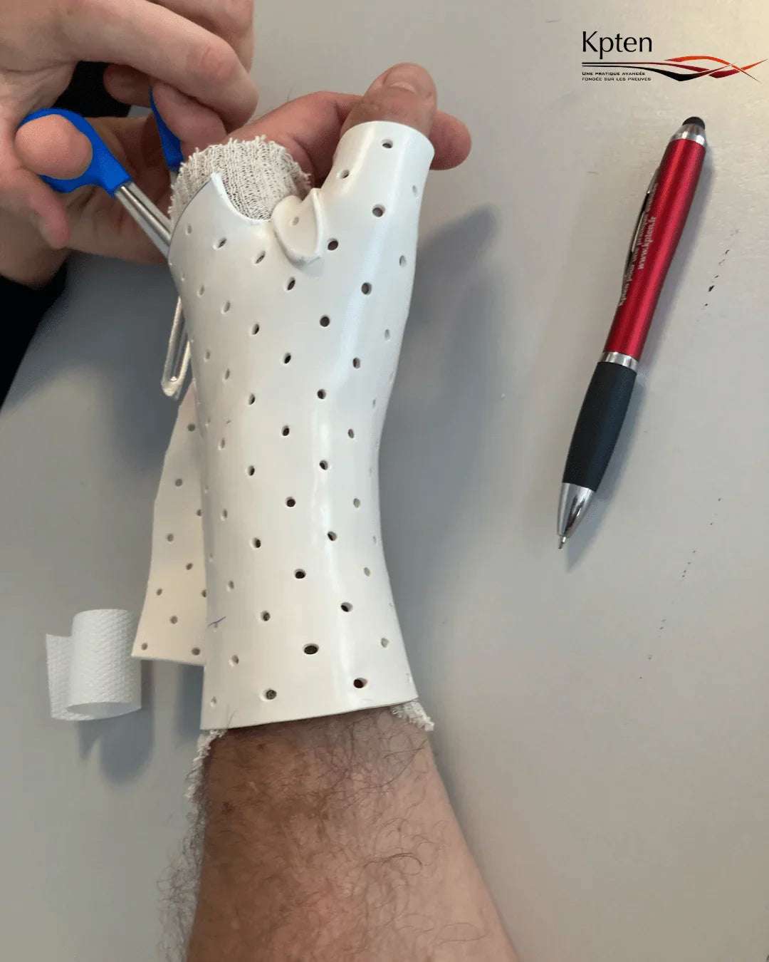 Orthèse de main thermoformée en cours d’ajustement, kinésithérapie Kpten Formation