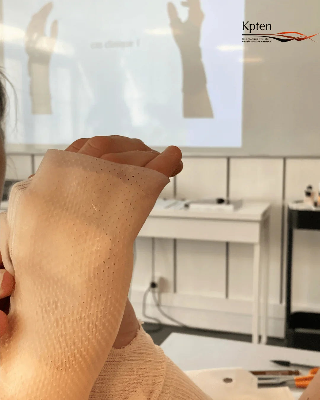 Application d’une orthèse de la main en atelier de formation kinésithérapie Kpten.
