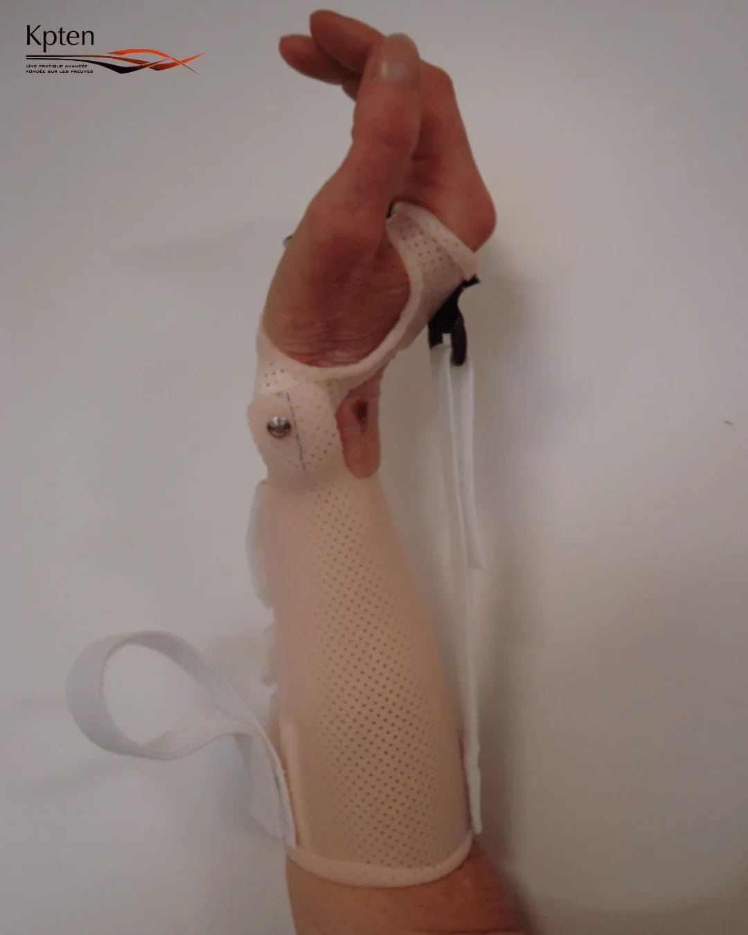 Orthèse de main thermoplastique sur avant-bras, formation kinésithérapie Kpten