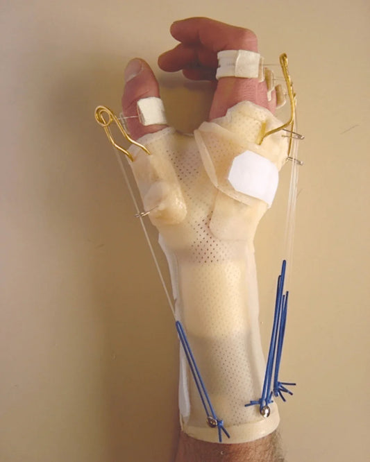 Orthèse de la main en résine pour rééducation kinésithérapie, vue sur avant-bras et doigts.